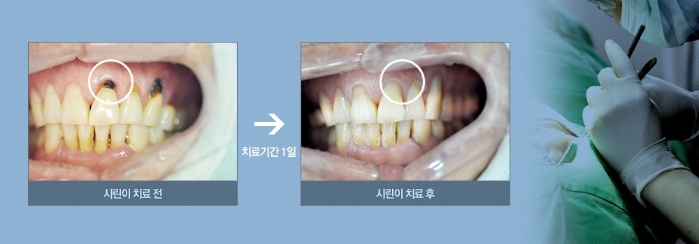 전후사진