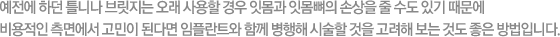 예전에 하던 틀니나 브릿지는 오래 사용할 경우 잇몸과 잇몸뼈의 손상을 줄 수도 있기 때문에 비용적인 측면에서 고민이 된다면 임플란트와 함께 병행해 시술할 것을 고려해 보는 것도 좋은 방법입니다.