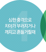 심한 충격으로 치아가 부러지거나 깨지고 흔들거릴때