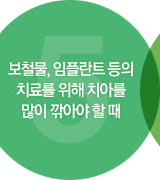 보철물, 임플란트 등의 치료를 위해 치아를 많이 깎아야 할 때