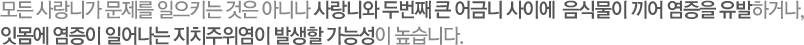 모든 사랑니가 문제를 일으키는 것은 아니나 사랑니와 두번째 큰 어금니 사이에  음식물이 끼어 염증을 유발하거나, 잇몸에 염증이 일어나는 지치주위염이 발생할 가능성이 높습니다. 