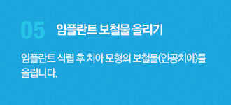 05.임플란트 보철물 올리기