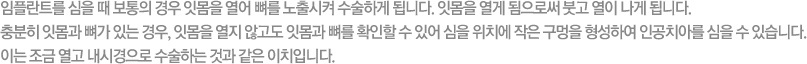 임플란트를 심을 때 보통의 경우 잇몸을 열어 뼈를 노출시켜 수술하게 됩니다. 잇몸을 열게 됨으로써 붓고 열이 나게 됩니다. 충분히 잇몸과 뼈가 있는 경우, 잇몸을 열지 않고도 잇몸과 뼈를 확인할 수 있어 심을 위치에 적은 구멍을 형성하여 인공치아를 심을 수 있습니다. 이는 조금 열고 내시경으로 수술하는 것과 같은 이치입니다.