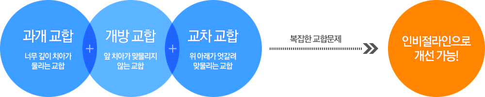 과개교합+개방교합+교차교합=인비절라인으로 개선가능!