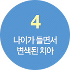 4.나이가 들면서 변색된 치아