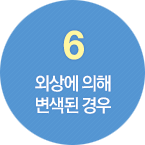 6.외상에 의해 변색된 경우